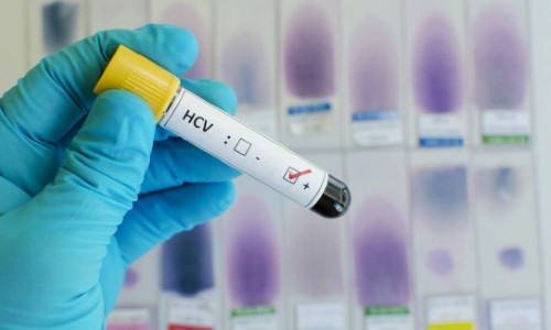 Brasil será o primeiro país de América Latina a eliminar a hepatite C
